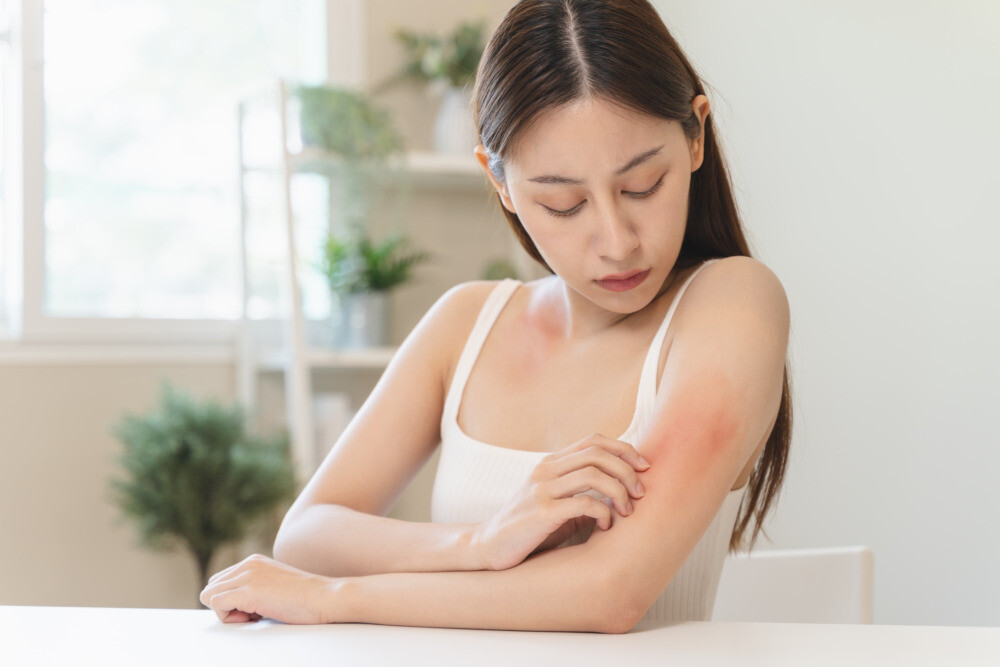 vrouw smeert arm in
